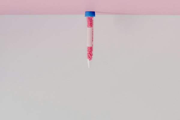 What Are the Current UK Guidelines for Thyroid Screening During First Trimester?